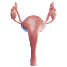 Diagram of the female reproductive system showing the ovaries, fallopian tubes, uterus, and vagina.